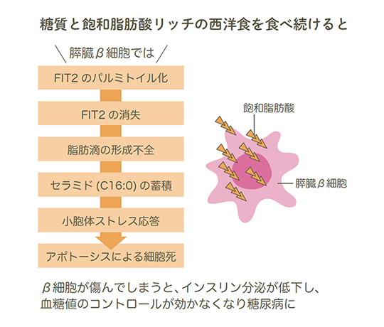 糖質と飽和脂肪酸リッチの西洋食を食べ続けると